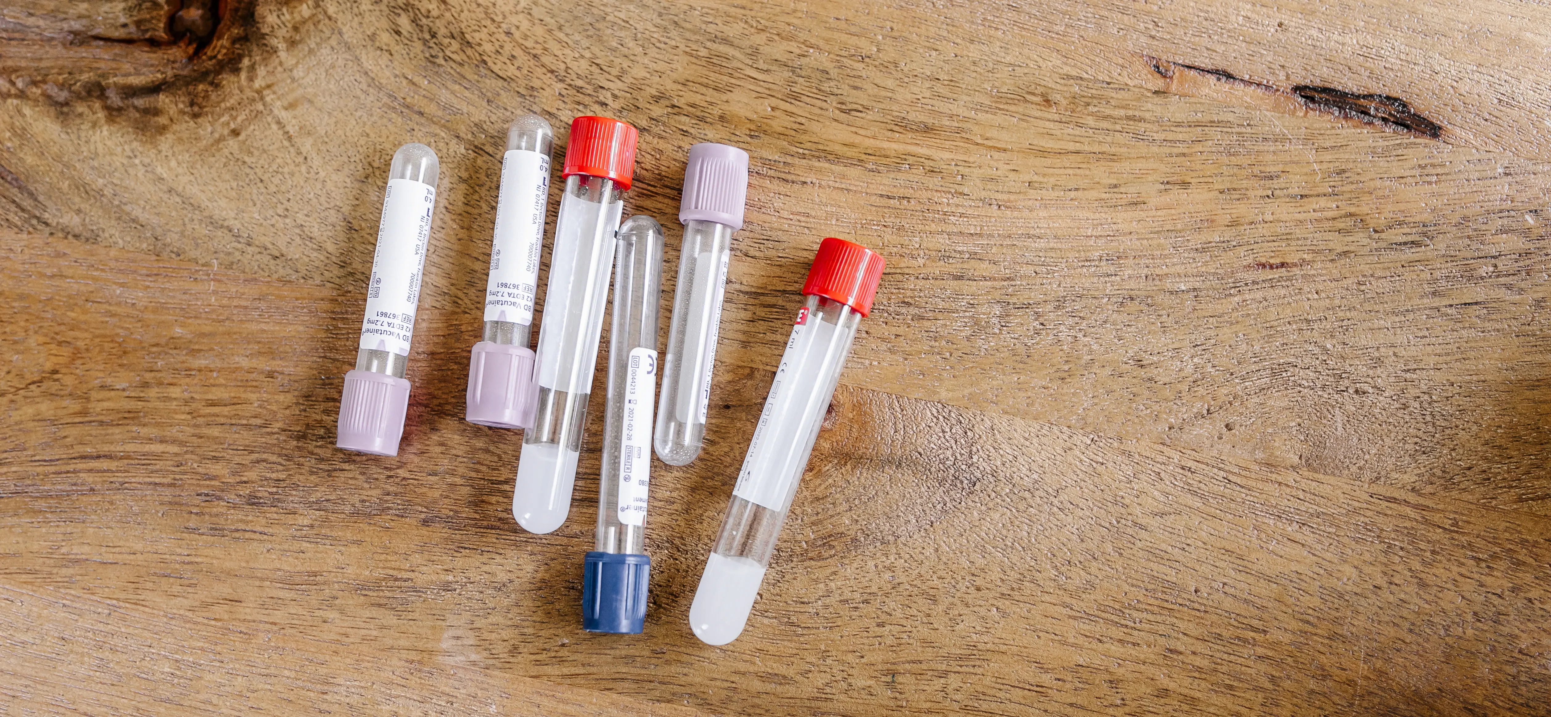 Blood collection tubes on a wooden desk — the advanced testing behind a complete clinical picture